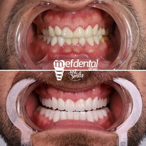 Image of Mefdental Global Gallery 1