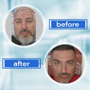 Image of Este Prime Clinic Hair Transplant and Aesthetic Center Turkey Gallery 3