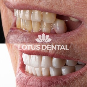 Image of Lotus Dental Clinic Gallery 0