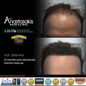 Image of Anastasakis Hair Clinic Gallery 1