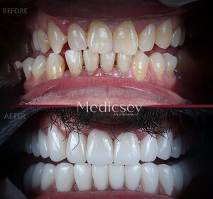 Image of Dental treatment before and after