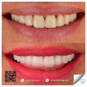 Image of Tuncer Oral and Dental Health Clinic Gallery 1