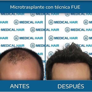 Image of Medical Hair Spain Gallery 1