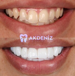 Image of Antalya Akdeniz Dental Clinic Gallery 3