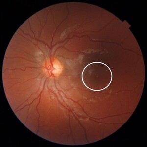 Image of Dr. Hantera Eye Clinic offers advanced diagnostics for eye conditions. 