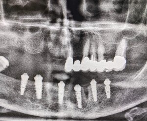 Image of AB Dental Implants Italia Gallery 0