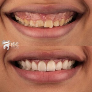 Image of Asnan Dental Center Gallery 2