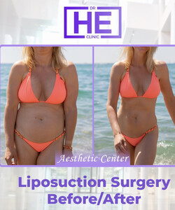 Image of Dr HE Aesthetic Clinic Gallery 3