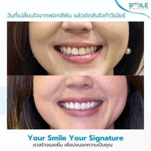 Image of Smile Signature Dental Clinic Gallery 3