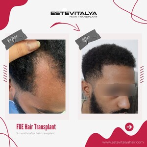 Image of Estevitalya Hair Gallery 1