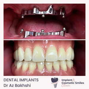 Image of The Implant and Cosmetic Smiles Clinic Gallery 1