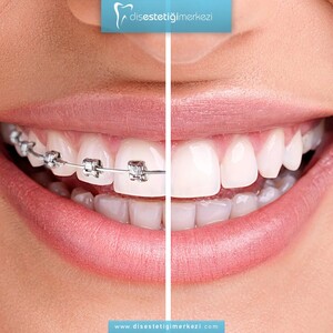 Image of Dental Aesthetics Center Gallery 2