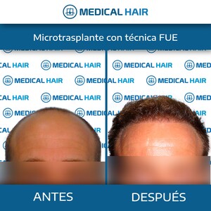 Image of Medical Hair Spain Gallery 2