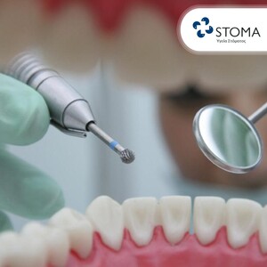 Image of Dental treatment - Stoma Dental Clinic