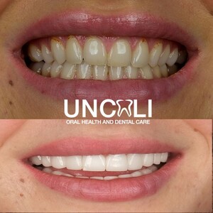 Image of Uncalı Dental Clinic Gallery 2