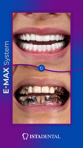 Image of Istadental - Istanbul Dental Aesthetic Clinic Gallery 5