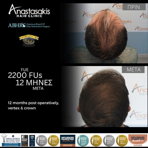 Image of Anastasakis Hair Clinic Gallery 2