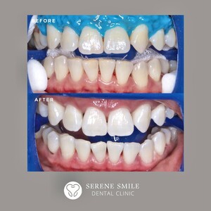 Image of Serene Smile Dental Clinic Gallery 0