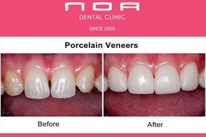 Image of NOA Dental Clinic Dubai Gallery 0