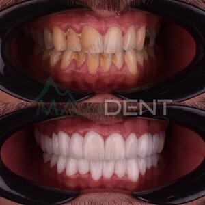 Image of Mazıdent Oral and Dental Health Clinic Gallery 1