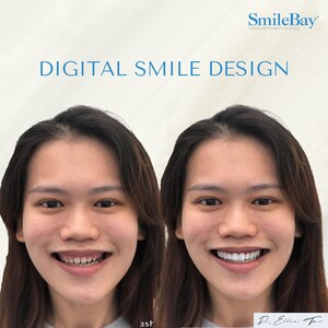 Image of Smilebay Dental Gallery 1