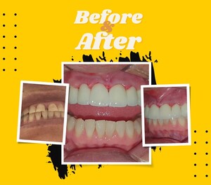 Image of Smile makeover