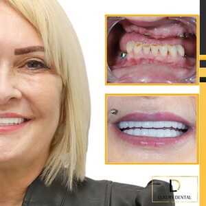 Image of Luxury Dental Turkey Gallery 1