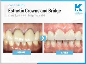 Image of K Family Dentistry Gallery 0