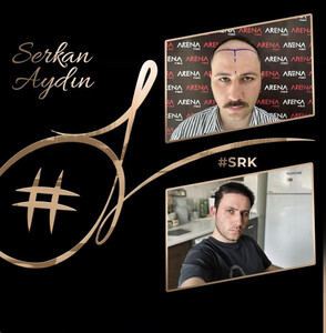 Image of Serkan Aydin Hair Clinic Gallery 0