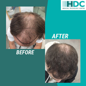 Image of HDC Hair Clinic Gallery 1