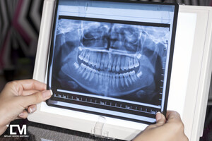 Image of Implant Centre Martinko Gallery 2