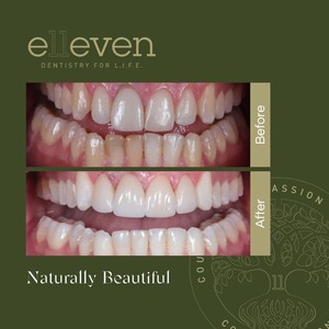 Image of Elleven Dental Gallery 3