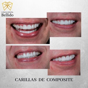 Image of Clínica Dental Bellido Gallery 2