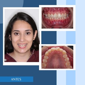 Image of After dental treatment