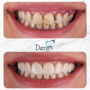 Image of Dent X Dental Polyclinic Gallery 3