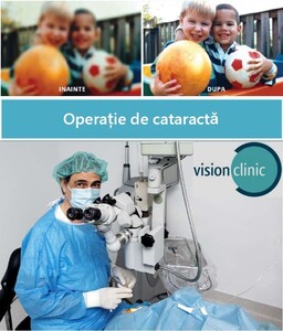 Image of Cataract Operation - Vision Clinic