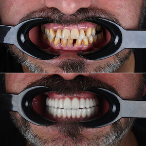 Image of Creative Smiles Turkey (CS) Dental Clinic Gallery 0