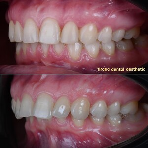 Image of Tirana Dental Aesthetic(TDA) Gallery 2