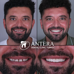 Image of Antera Dental Clinic Turkey Gallery 2