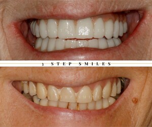 Image of 3StepSmiles Dental Clinic Liverpool Gallery 0