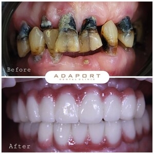 Image of Adaport Dental Clinic Gallery 1