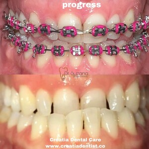 Image of Croatia Dental Care Gallery 3