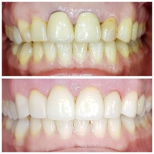 Image of Smile makeover