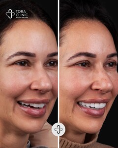 Image of Smile makeover results