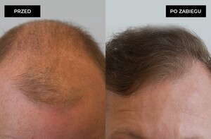 Image of Dr. Pyziak Hair Transplant Center Gallery 2