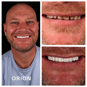 Image of Orion Dental Health Gallery 2