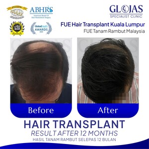 Image of Hair Loss Specialist Consultation