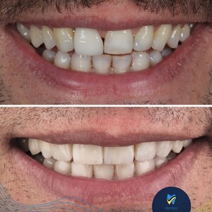 Image of Dentes Dental Clinic Gallery 3