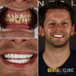 Image of Umut Dental Clinic Antalya Gallery 1