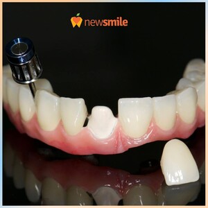 Image of New Smile Dental Clinic Gallery 3